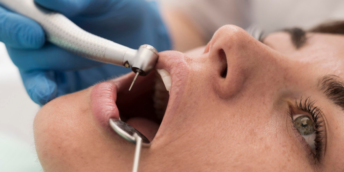 Root Canal Treatment: A Complete Guide to Saving Your Natural Tooth