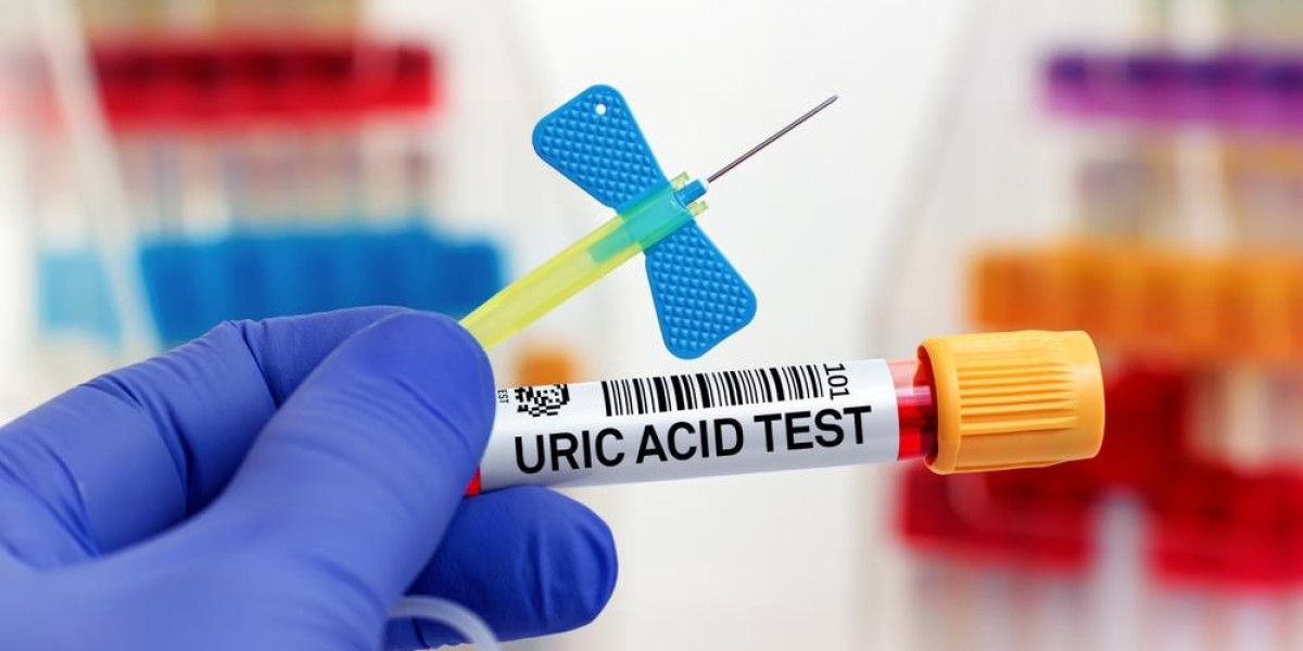 How a Uric Acid Test Helps Detect Metabolic and Joint Disorders