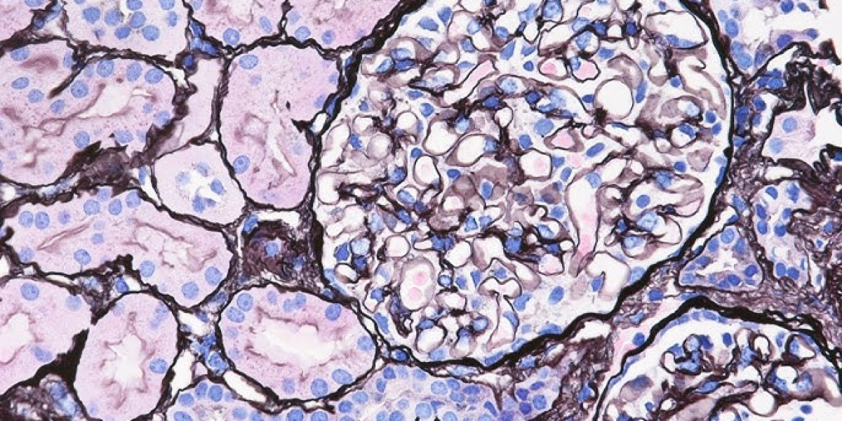 Exploring Rare Kidney Disorders: Science, Support, and Hope for Patients