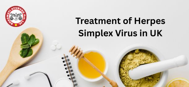 Treatment of Herpes Simplex Virus in UK - Bhagwati Ayurved