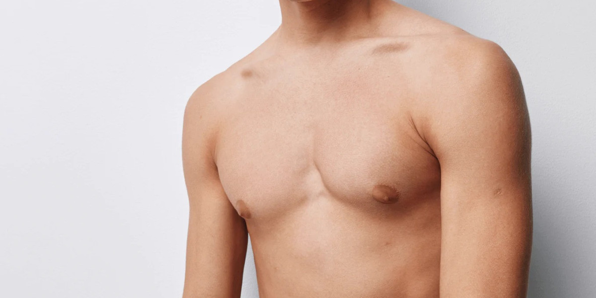 Can Gynecomastia Reoccur After Treatment in Dubai?