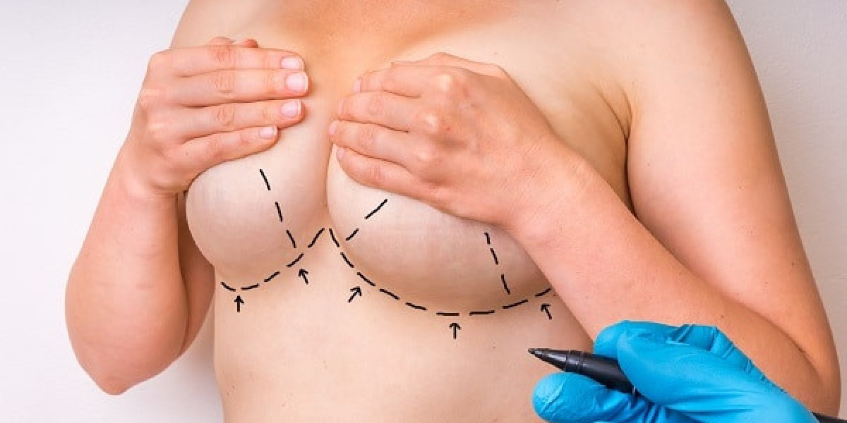 Reveal a Softer, More Youthful Silhouette With Breast Lift Dubai