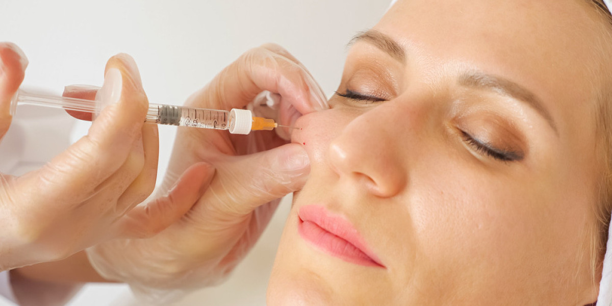 Cheek Fillers Injections Recovery Timeline Explained