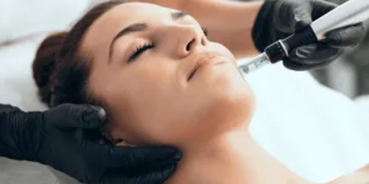 Affordable Microneedling Treatment in Houston for Acne Scars and Fine Lines