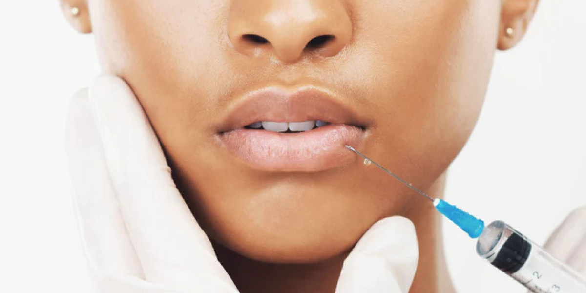 Lip Fillers at The Medispa: Enhance, Define, and Embrace Your Natural Smile