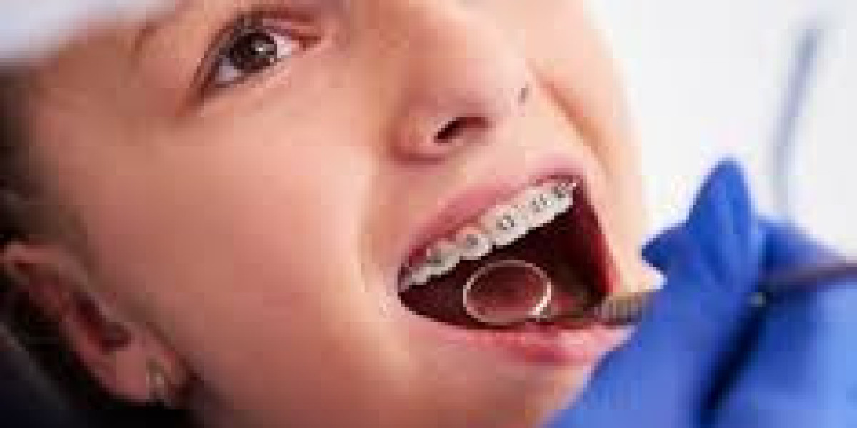 What to Expect When Getting Dentures: A Step-by-Step Patient Guide