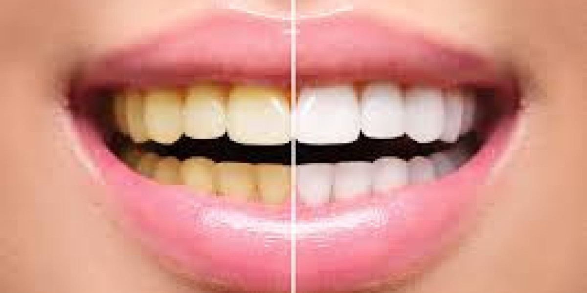 The Role of Preventive Dentistry in Your Child’s Development